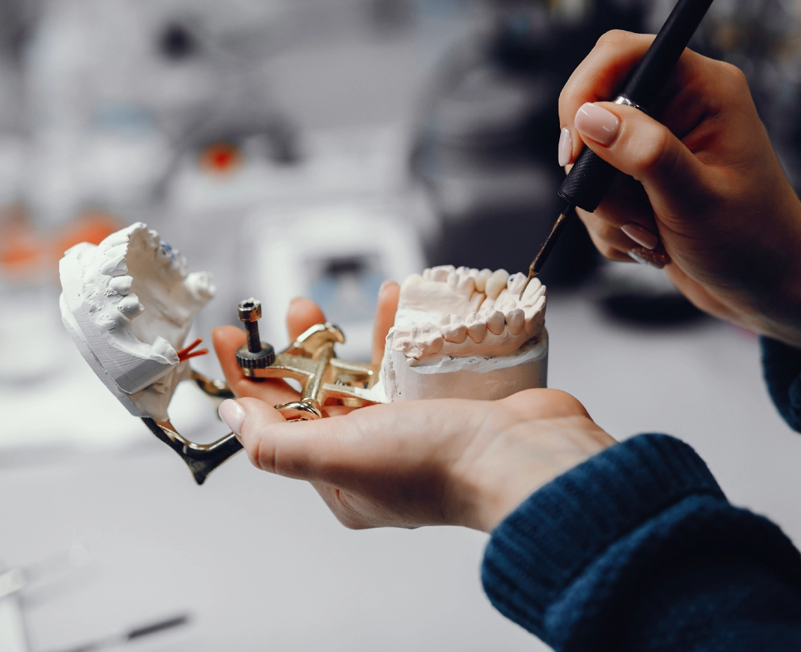 Implantes dentales majadahonda